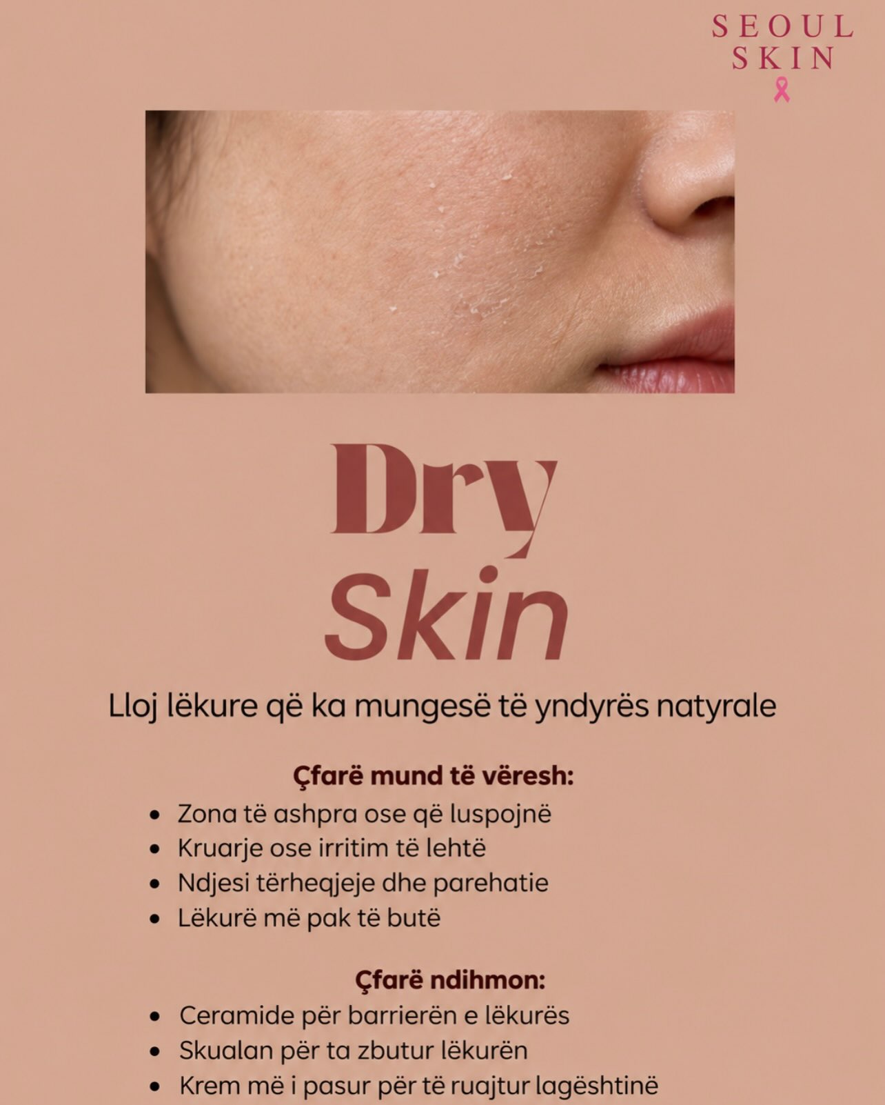 Lëkurë e thatë apo e dehidratuar? – seoulskin.ks (2)