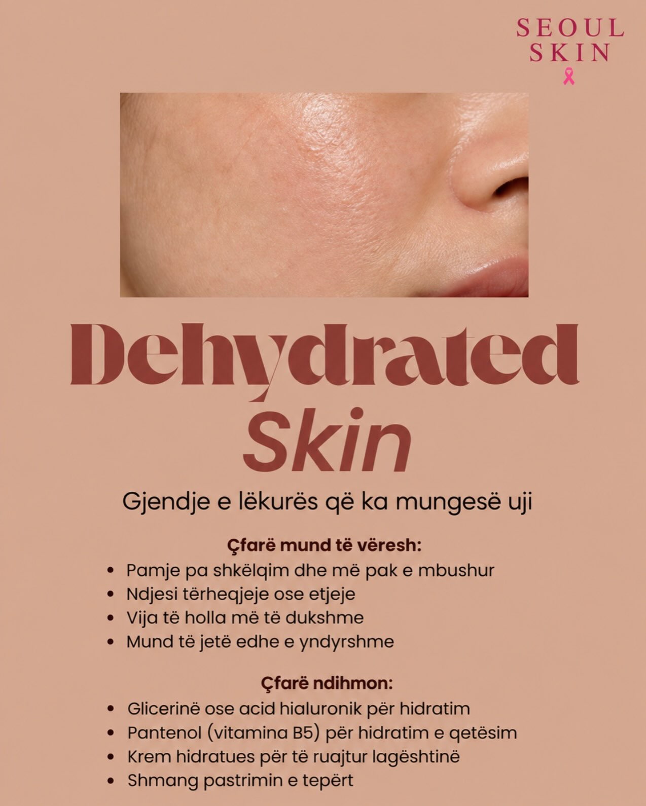 Lëkurë e thatë apo e dehidratuar? – seoulskin.ks (3)