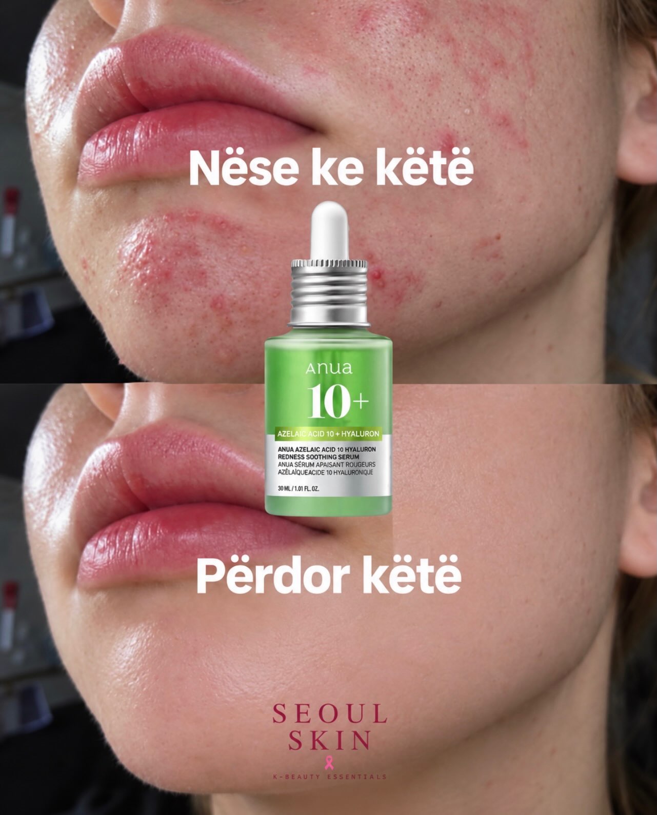 7 produkte, po cili është për ty? – seoulskin.ks (2)
