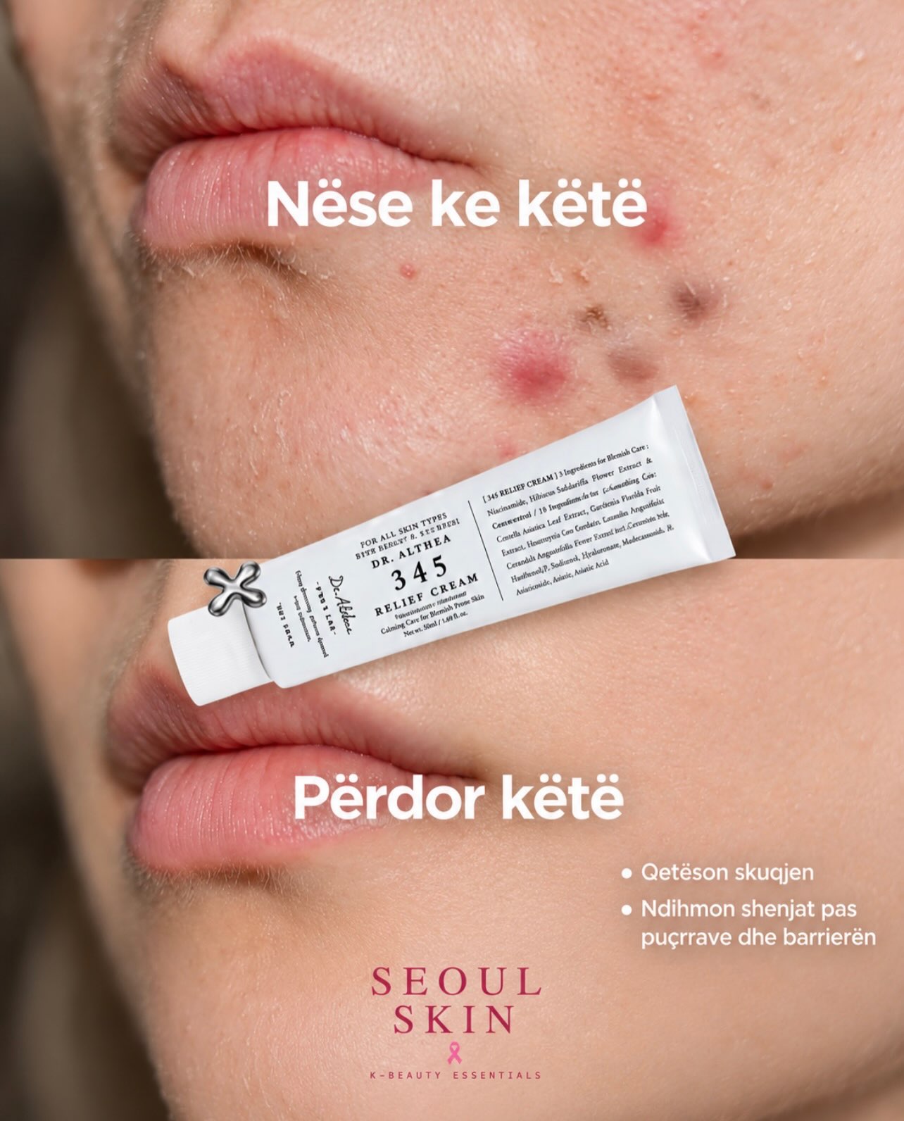 7 produkte, po cili është për ty? – seoulskin.ks (3)