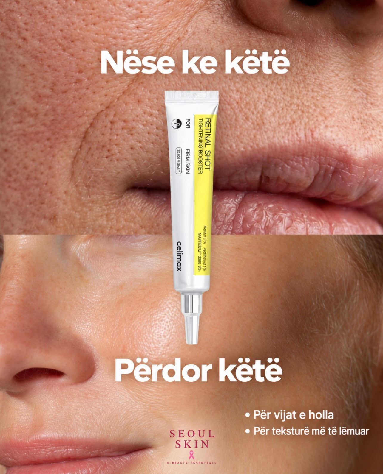 7 produkte, po cili është për ty? – seoulskin.ks (4)