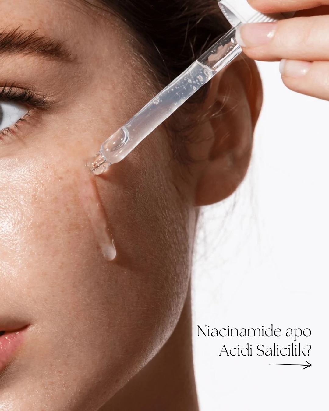 Niacinamide apo Acid Salicilik?