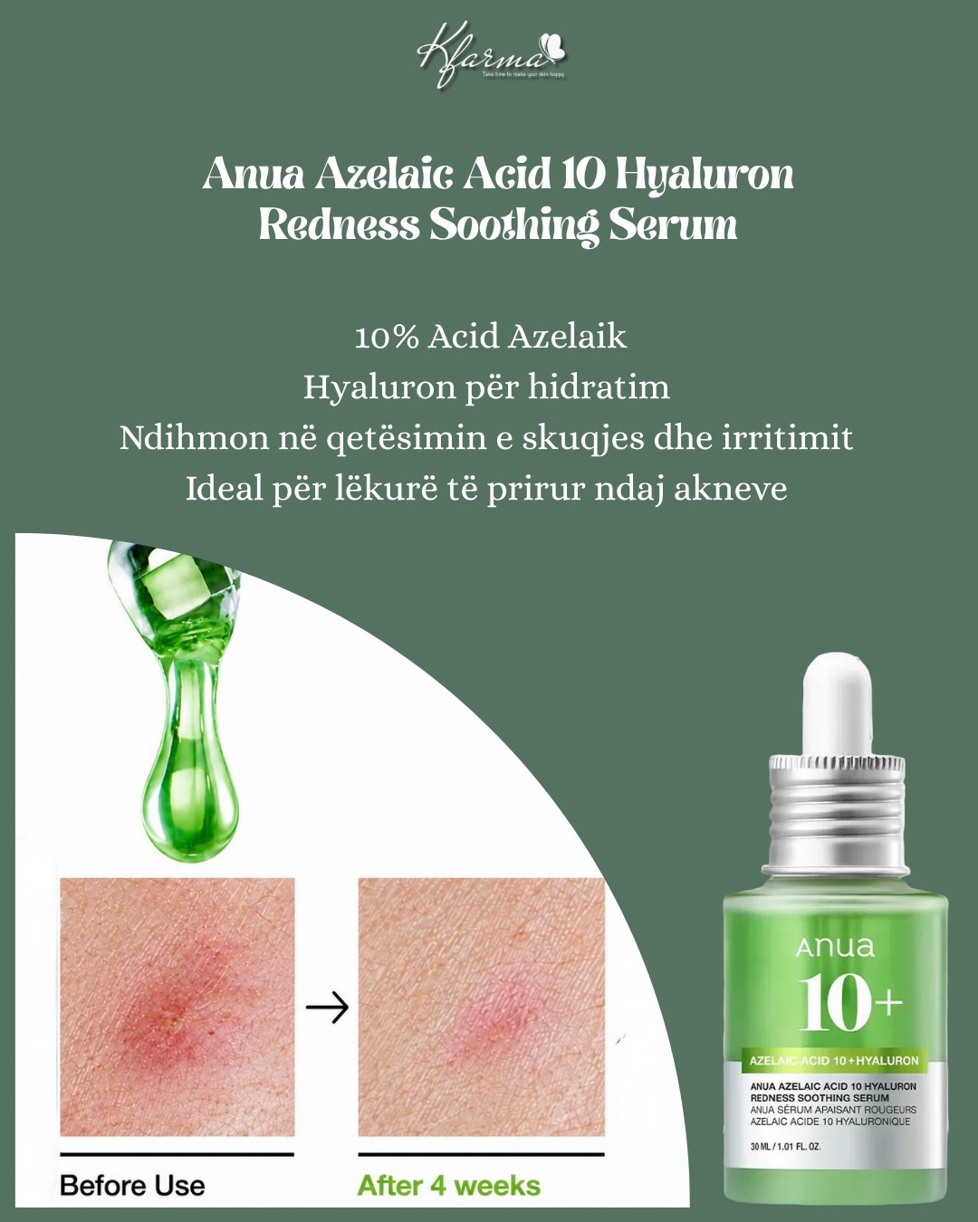 Serum Anua Azelaic Acid 10 Hyaluron – Korean Beauty Store (2)