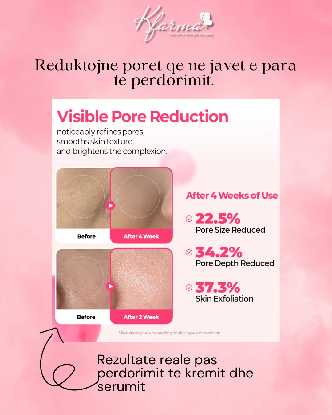 Produkte Dr. Melaxin me mikrogjilpëra – Korean Beauty Store (3)
