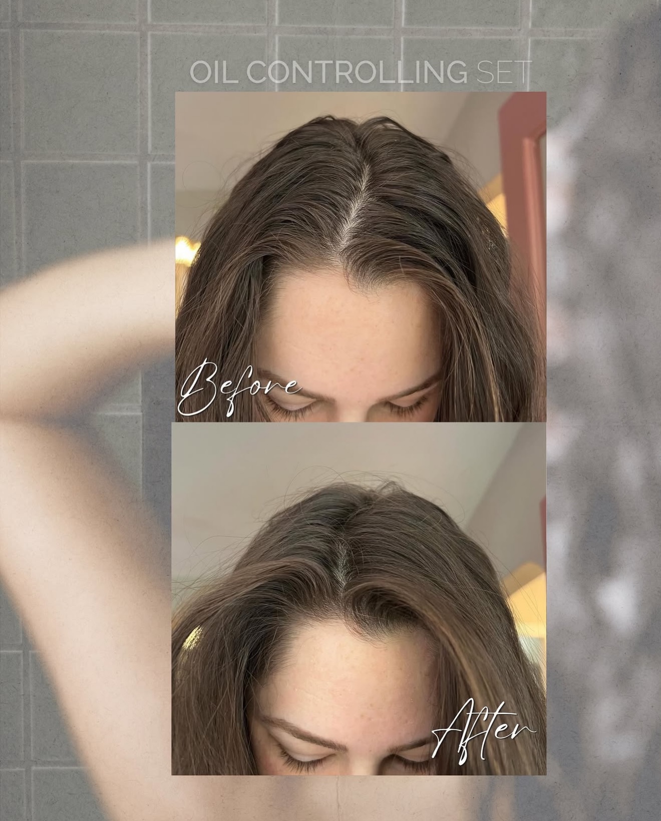 Set AMIS Beauty Oil Controlling, para dhe pas – Ami's Beauty Kosovo (2)
