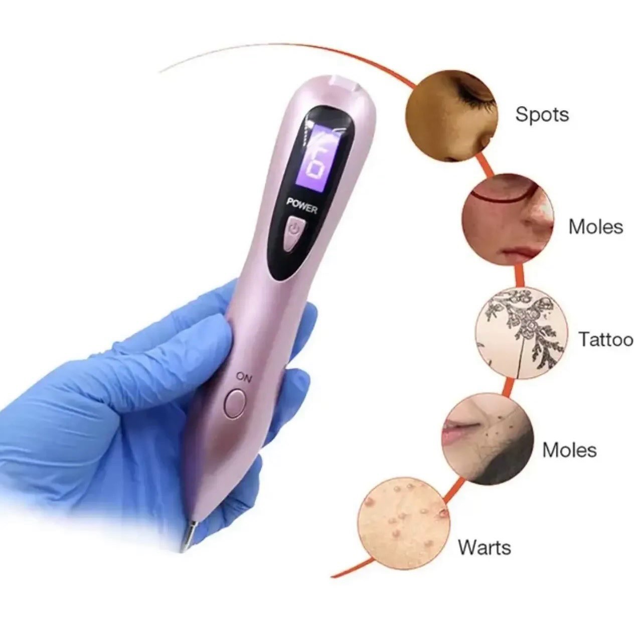Plasma pen për trajtime estetike të fytyrës – Produkte Kozmetike