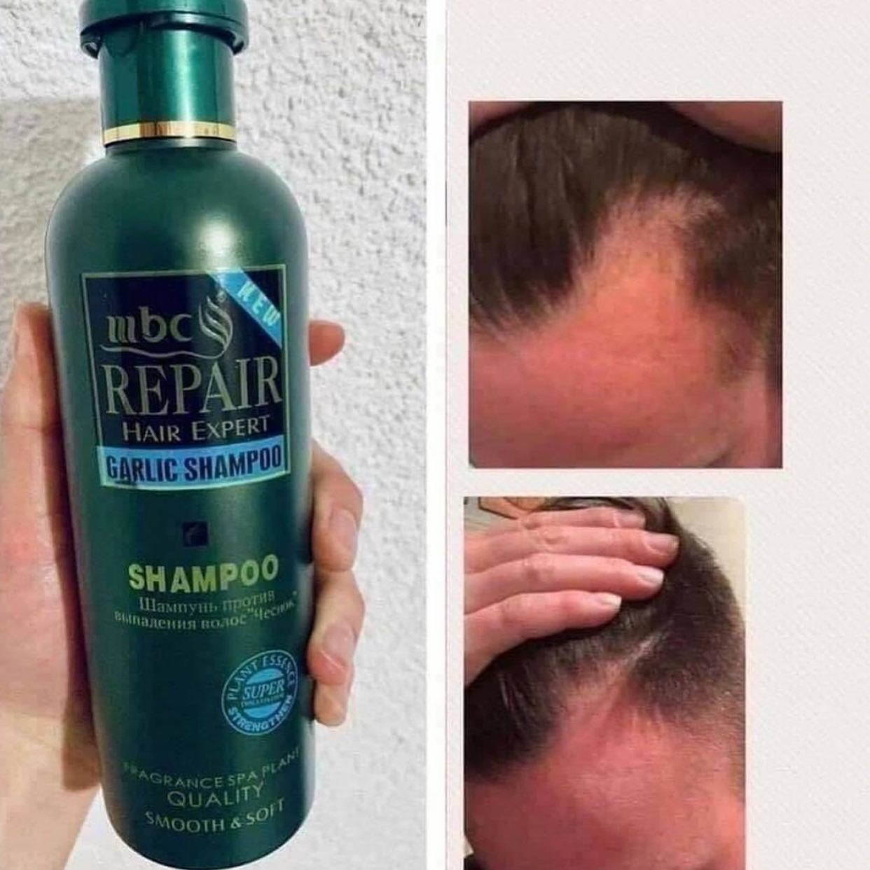 Shampo me hudhër 500 ml – Porosit nga shtepia🏠