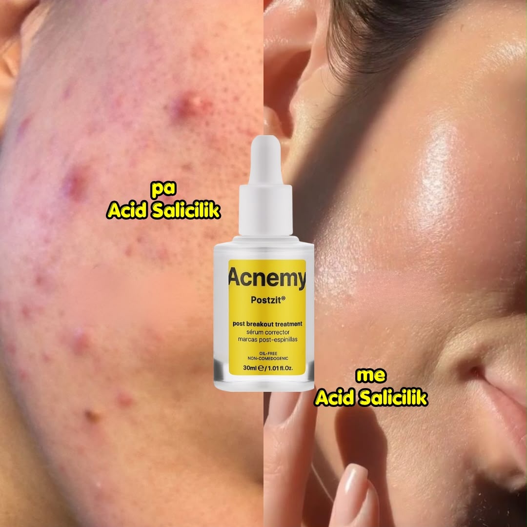 Serum fytyre me vitaminë C – Una Beauty (3)